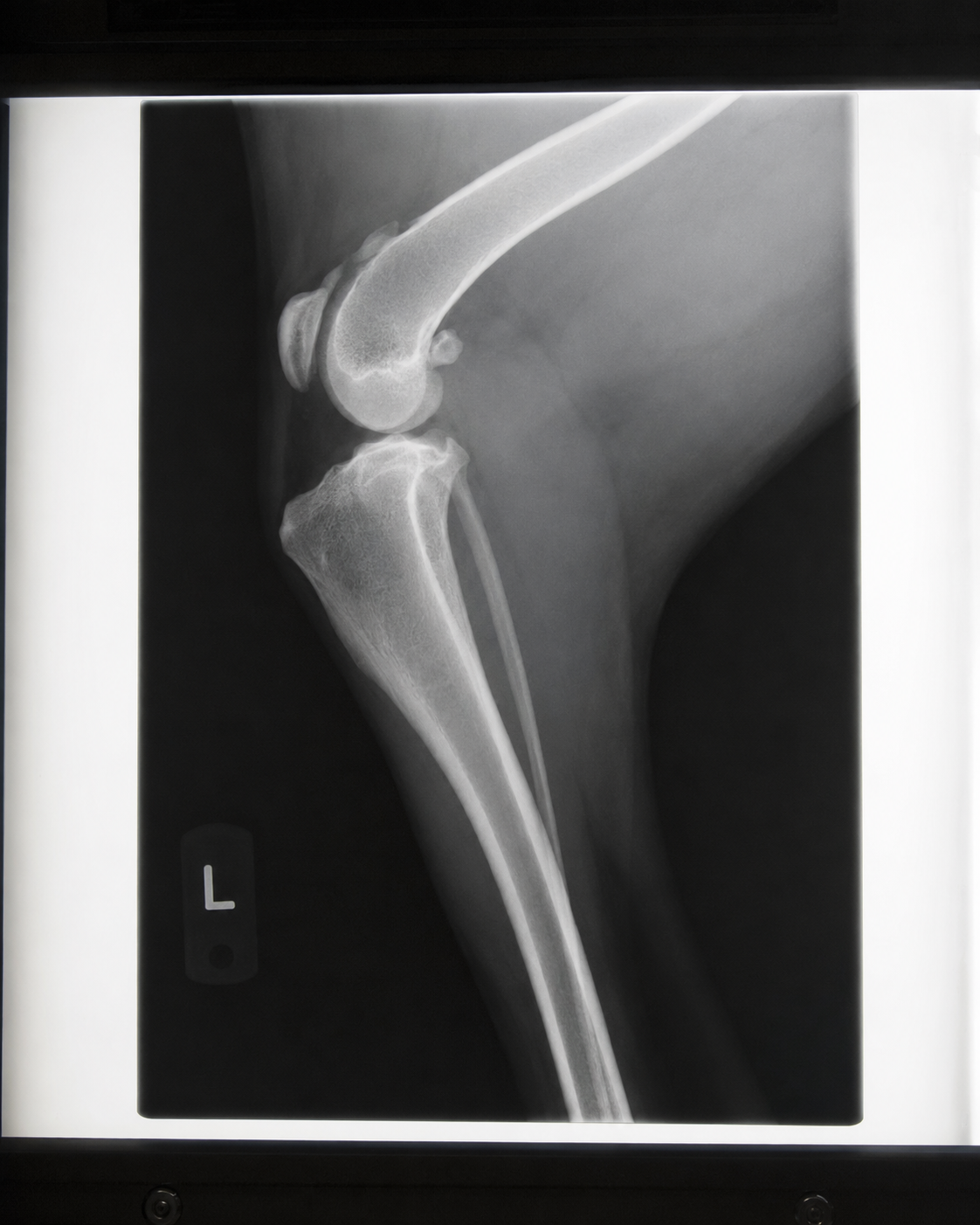 Conscious stifle radiograph